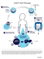 Catching up with the Chimeric Antigen Receptor T-cell therapy for Cancer treatment:  Cancer cure is no longer far thumbnail