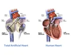 BIOMEDICAL ENGINEERING IN MEDICINE : THE CONCEPT AND FUTURE PROSPECTS thumbnail