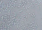 Medical laboratory workshop Episode 8: Clinical evaluation of vegetative forms of  Candida albicans  responsible for candidiasis in humans thumbnail