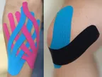  Exploring the orthodox and modern approaches to alleviation of pain in humans: how the use of Kinesio tapes have been beneficial - 2 thumbnail