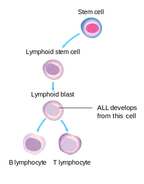 Original Research: Discussion on the role of Protein Kinase C in Acute lymphoblastic leukaemia  thumbnail