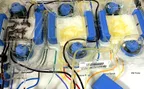 In-depth overview on the potential fatal complications of apheresis procedure thumbnail