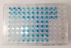 Discussion: Details on CVD Biomarker Laboratory Assessment and treatment using pharmaceutical drugs thumbnail