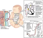 Detailed explanation on the challenges facing neonatal Cross matching thumbnail