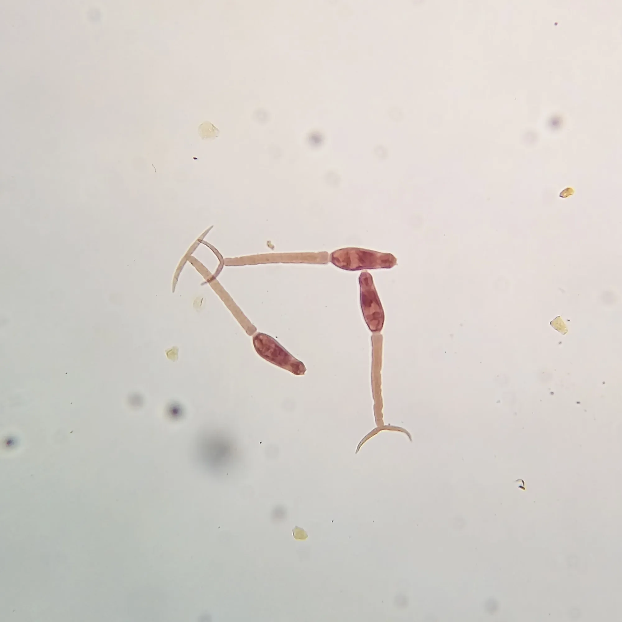 Schistosoma_mansoni_(Cercariae).jpg