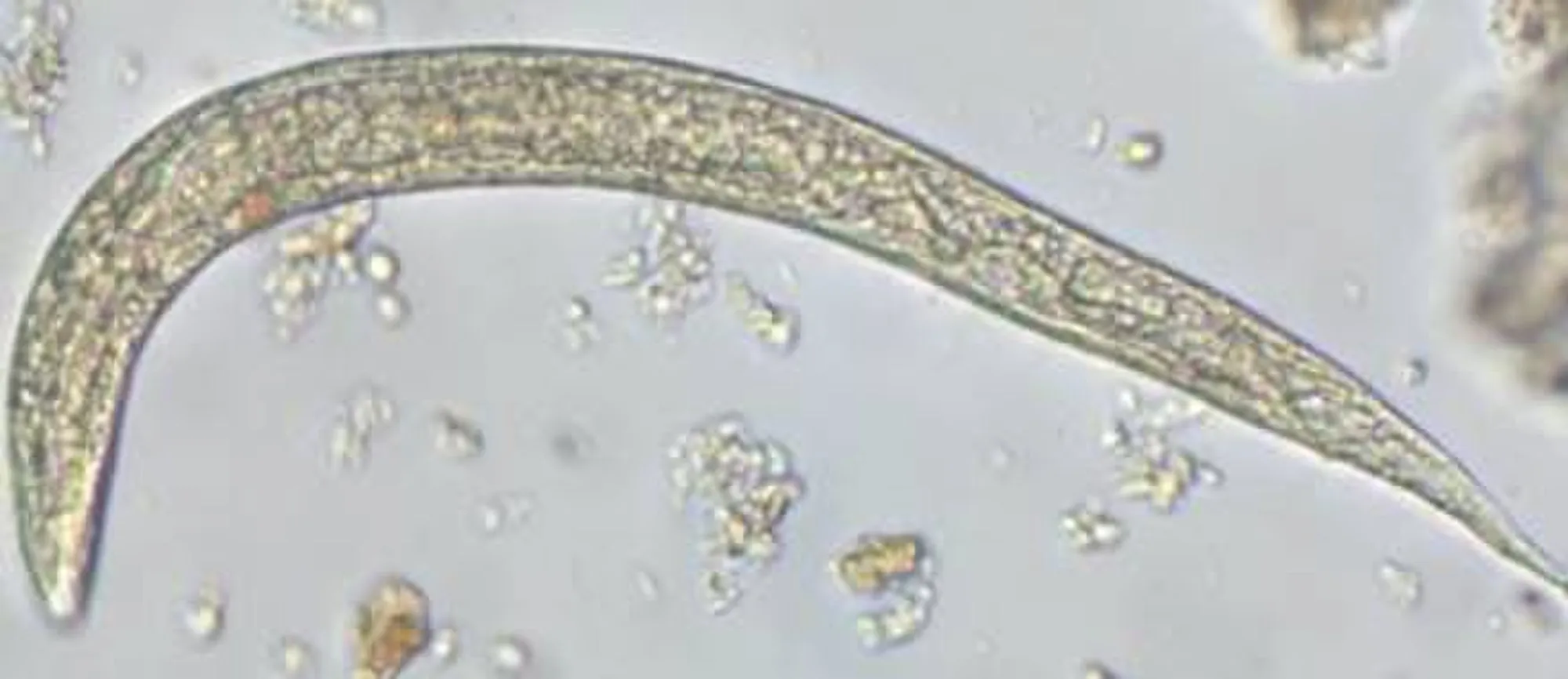 Parasite140080-fig3_Gastrointestinal_parasites_in_seven_primates_of_the_Taï_National_Park_-_Helminths_Figure_3n.jpg