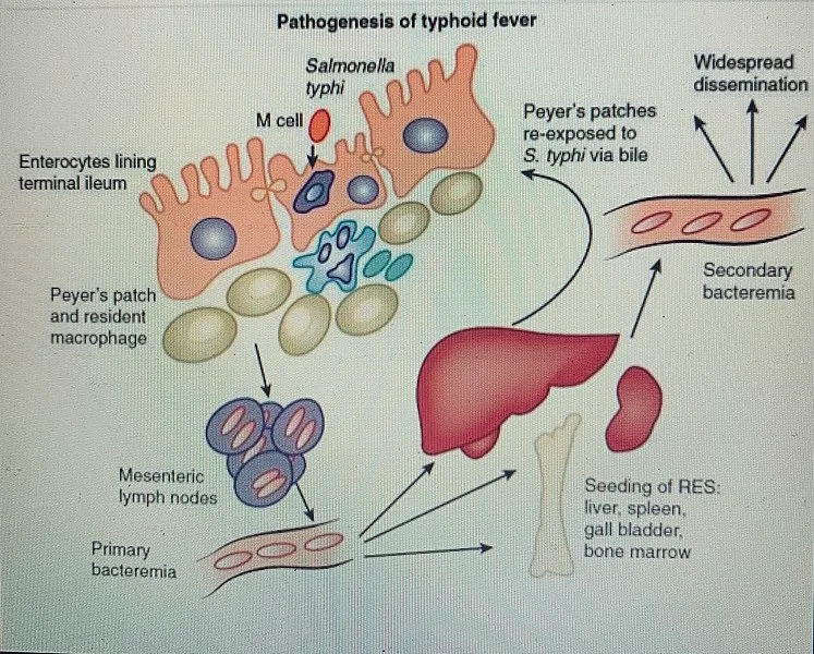 STyphipathogenesisdiagram.jpg