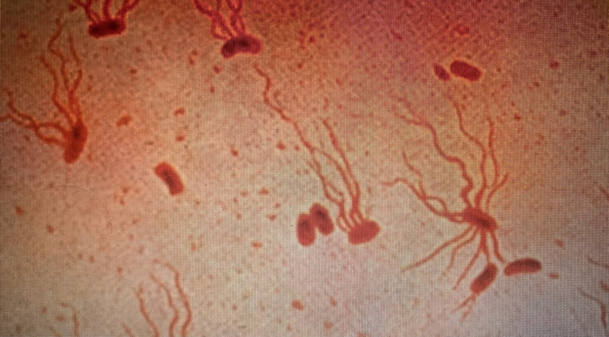 SalmonellaTyphiFlagellarStain.jpg