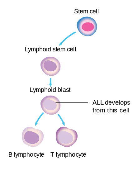 Diagram_showing_the_cell_that_ALL_starts_in_CRUK_295.svg.png