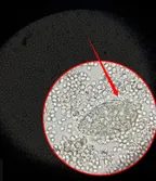 Medical laboratory workshop Episode 2 (A rare occurrence - Live view of Miracidium of Shistosoma haematobium after hatching from egg  thumbnail