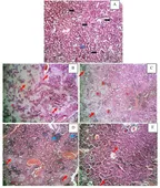 Original Research: Demonstrating the Protective effects black seed (Nigella sativa) extract has on the heart, kidney and the liver thumbnail