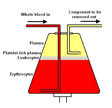 Apheresis.png