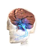 Aetiology of Headaches associated with prolonged use of face masks and respirators among health care workers thumbnail